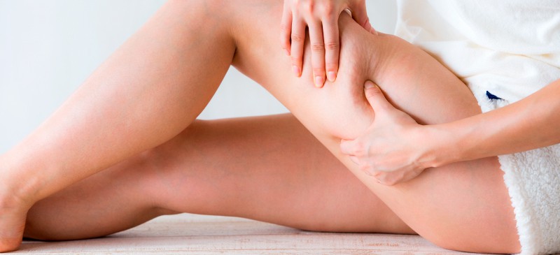 How to Get Rid of Cellulite: 6 Natural Treatments - Dr. Axe