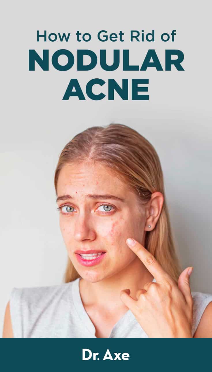 Nodular Acne Symptoms, Causes, Treatments and More Dr. Axe