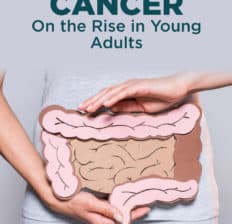 Colon cancer in young adults - Dr. Axe