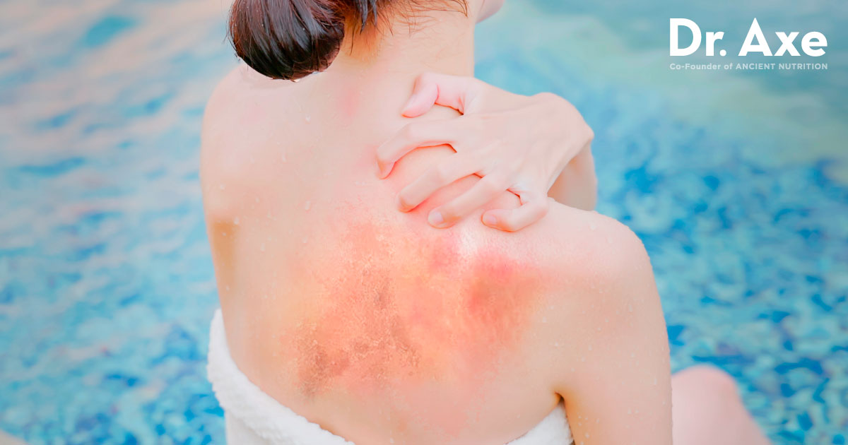 What is a Chlorine Rash? How Do You Treat and Prevent it? – TRIHARD