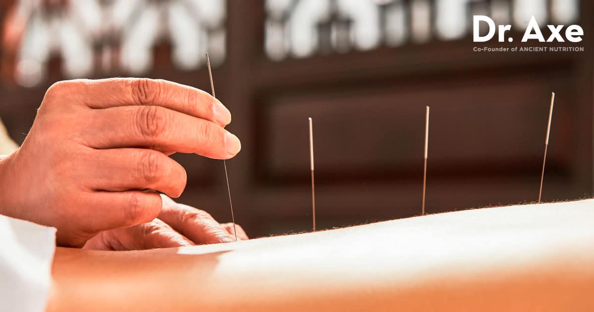 Fertility Acupuncture, London