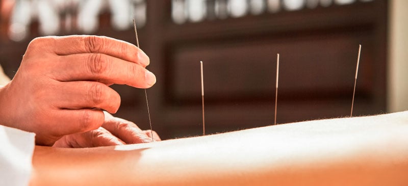 Acupuncture benefits