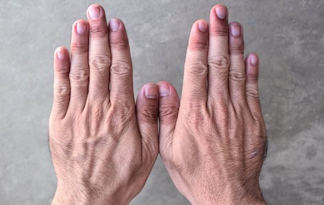 Bluish or purple nails