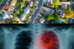 Radon Symptoms: Is This Deadly Gas Lurking in Your Home?